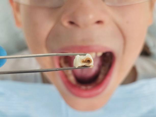 Best Emergency Treatment for Toothache in Granite, OK